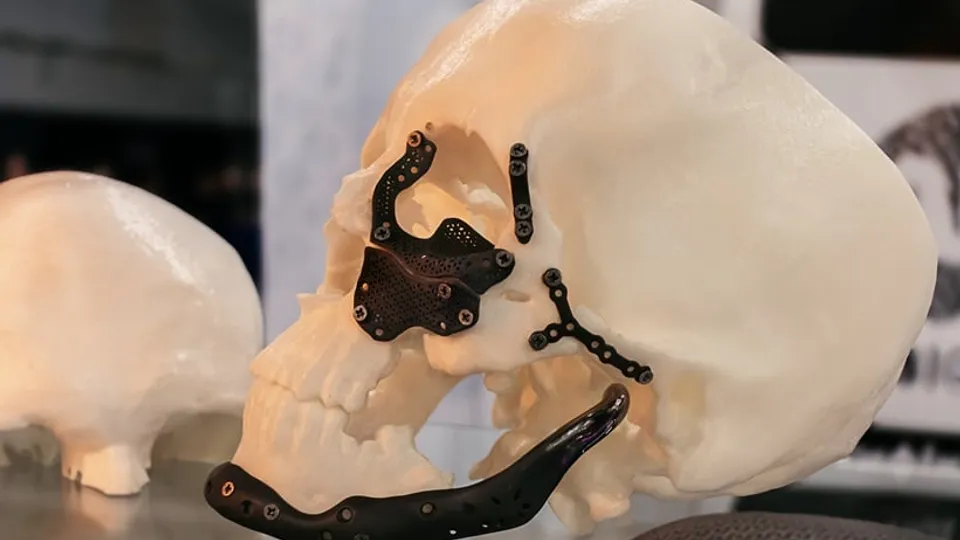 3D Printing Revolutionizes Surgical Training and Planning
