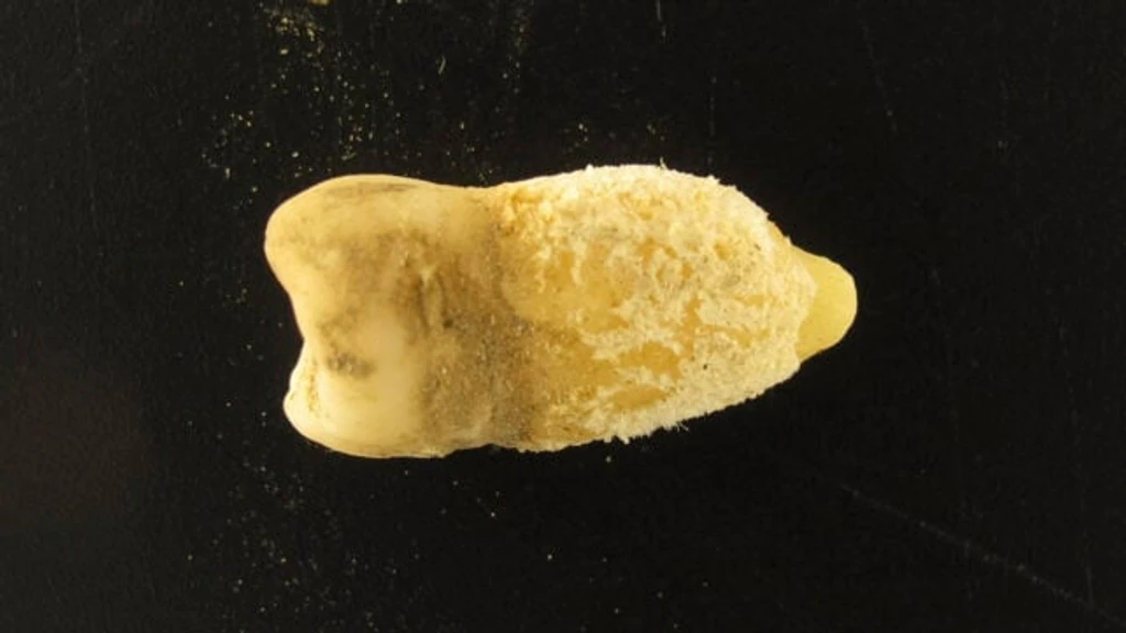 - Figure 1 - 