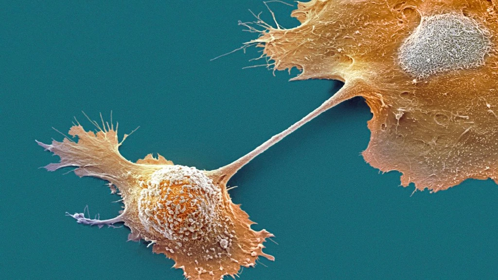 Experimental Drug Elraglusib Doubles Pancreatic Cancer Survival Rate