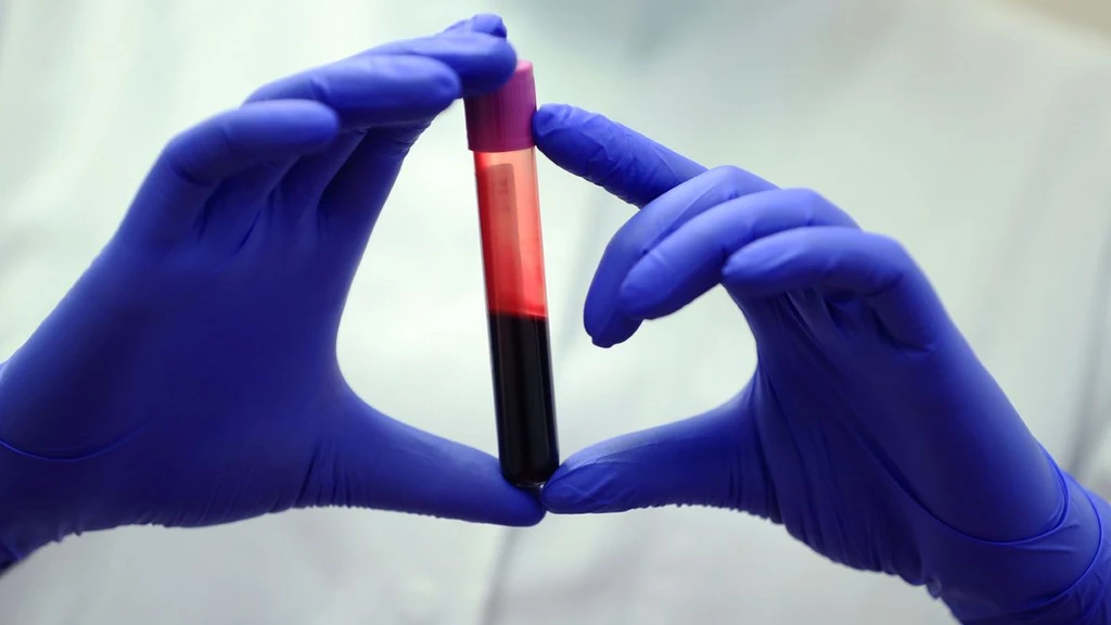 New Blood Test Detects Early Liver Scarring, Aims to Prevent Cancer