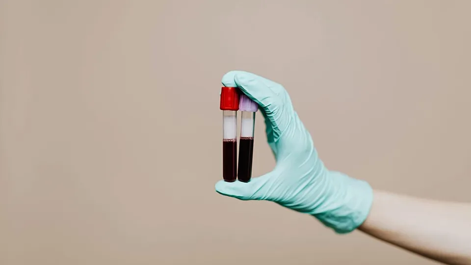 Simple Blood Test Predicts Longevity Risk, New Study Reveals