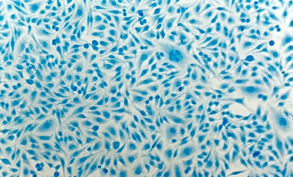 HIV-Positive Women Face Rising Cervical Cancer Risk with Age