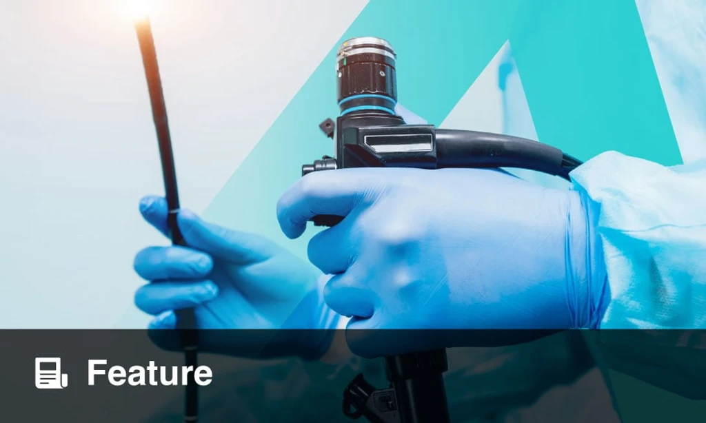 AI Revolutionizes Ulcerative Colitis Endoscopic Scoring