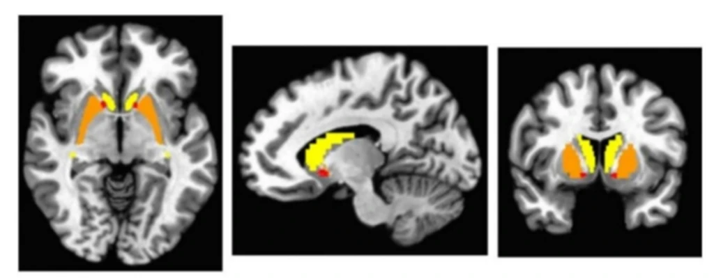 - Figure 1 - 