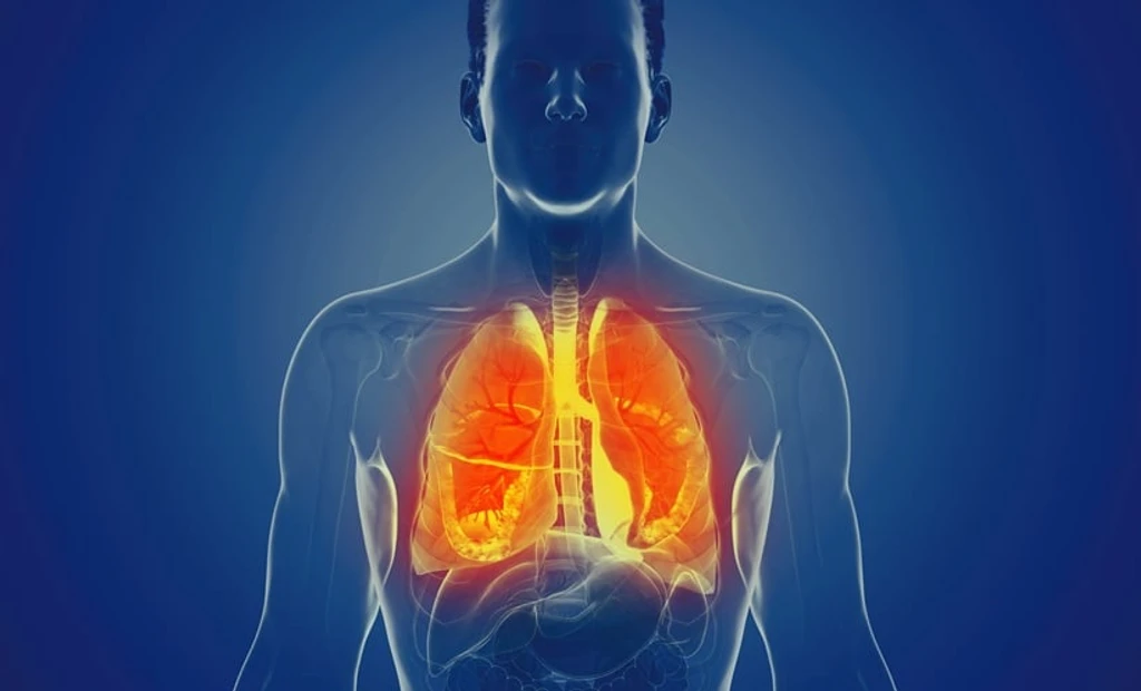 New Inhaled Therapy Aims to Heal Lungs Post-Infection