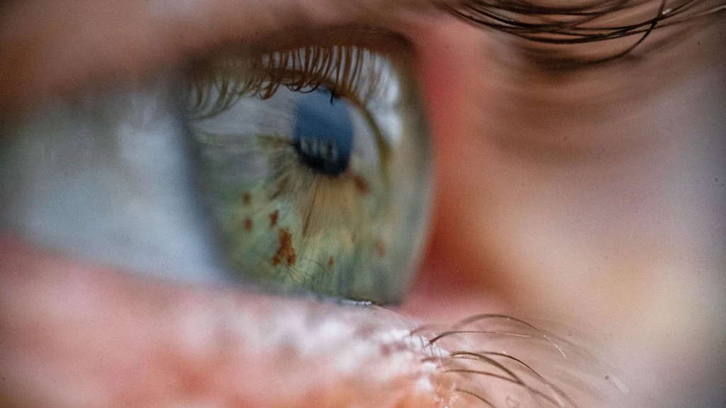 New Eye-Scan Test Detects Anemia Risk Without a Needle