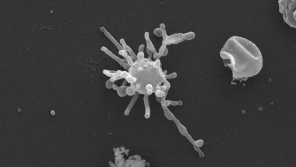 Ancient Microbe's Oxygen Use Offers Clue to Complex Life's Origin