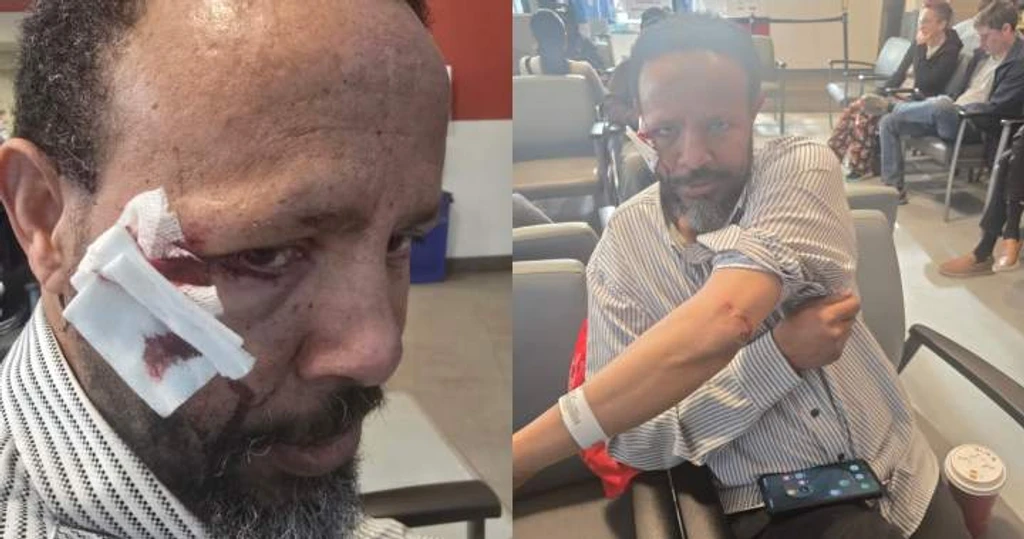 Hate-Motivated Attack After Friday Prayers Leads to Aggravated Assault Charge