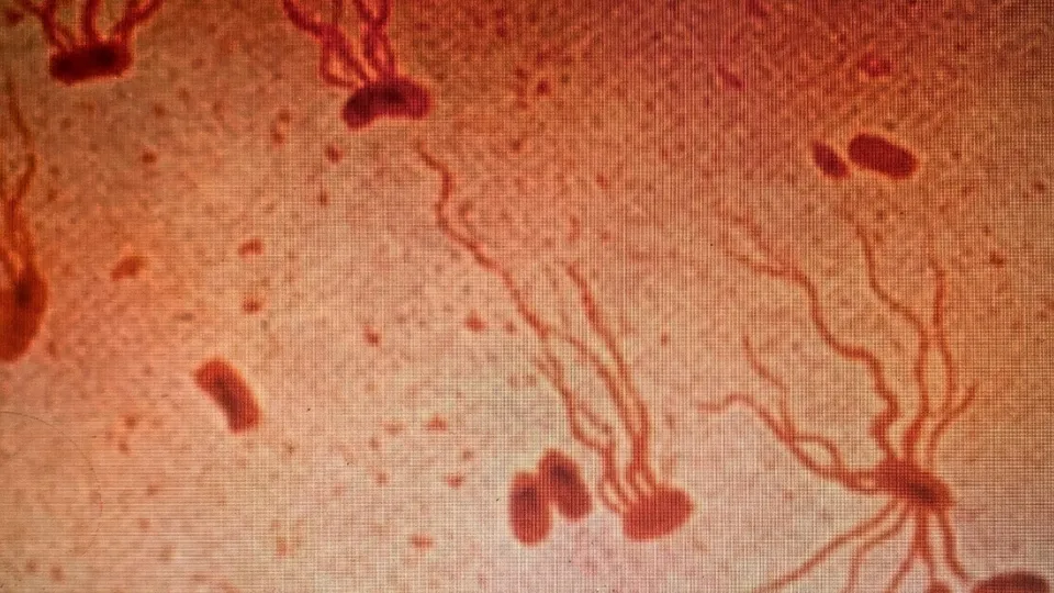 Ancient Killer Typhoid Fever Gains Dangerous Antibiotic Resistance