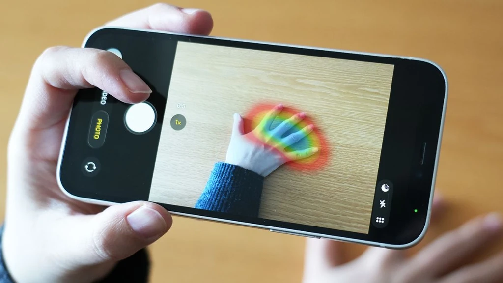 AI Detects Rare Hormone Disorder from Hand Photos