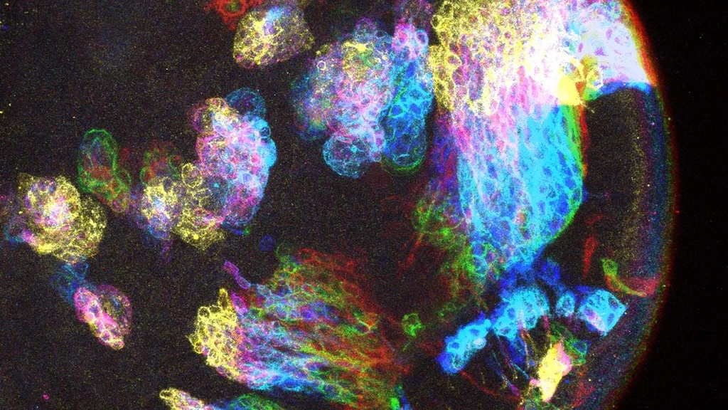 Fruit Fly Study Reveals Clue to Brain Cancer's Mysterious Origins