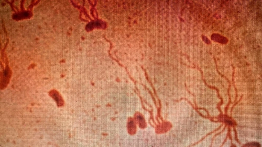 Typhoid Bacterium Evolves Extensive Drug Resistance, Study Warns