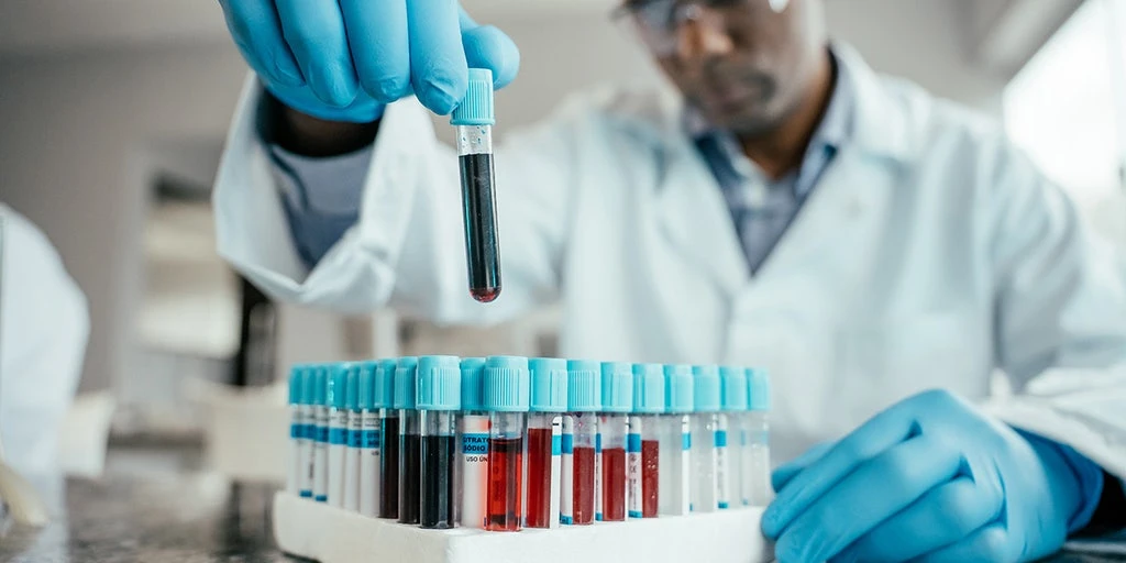 Blood's 'Biological Age' May Predict Dementia Risk, New Study Finds