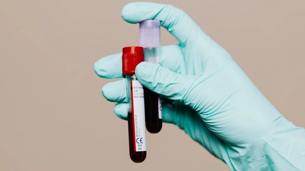New Blood Test Shows Promise for Early Alzheimer's Prediction