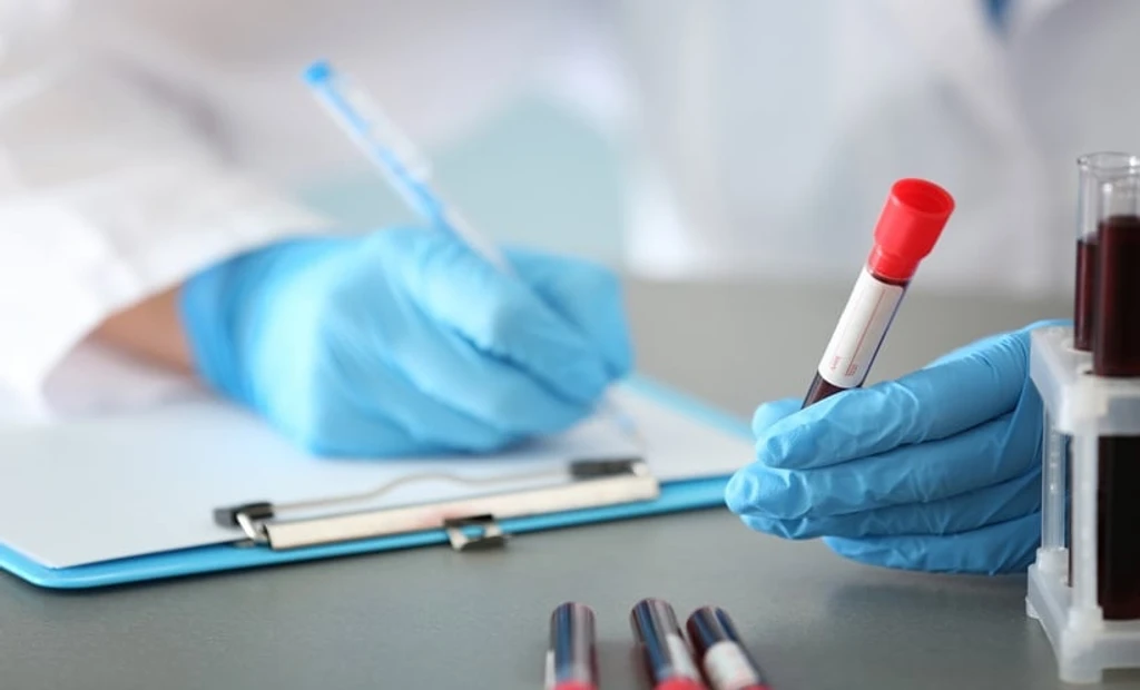 Blood Test Breakthrough to Detect Heart and Kidney Disease Earlier