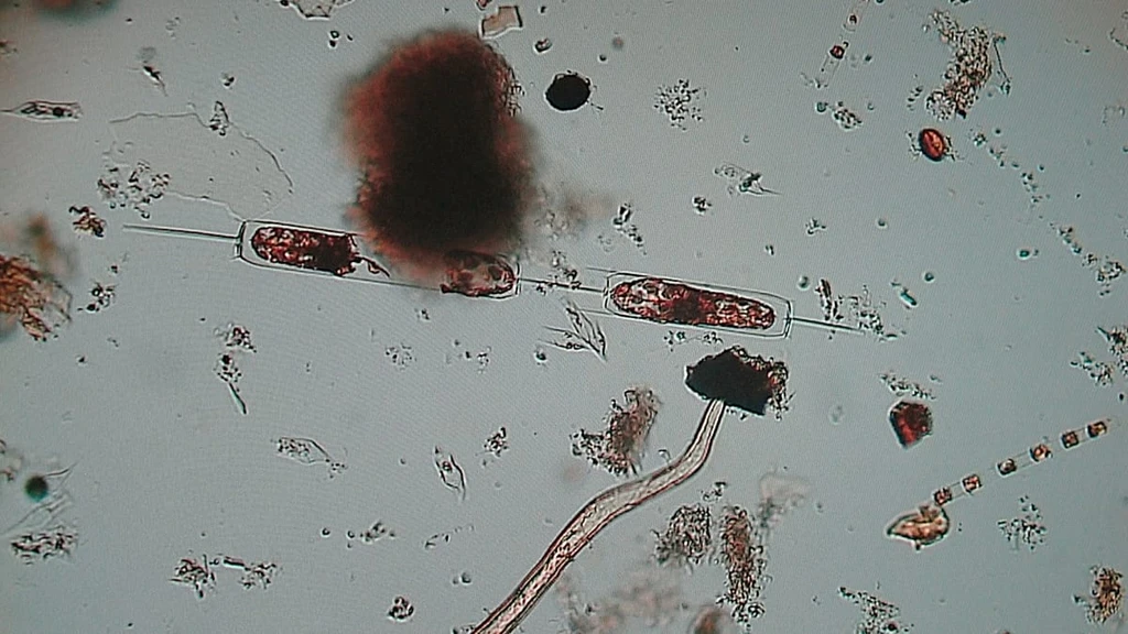 Deadly 'Flesh-Eating' Bacteria Surge Amid Rising Global Sea Temperatures