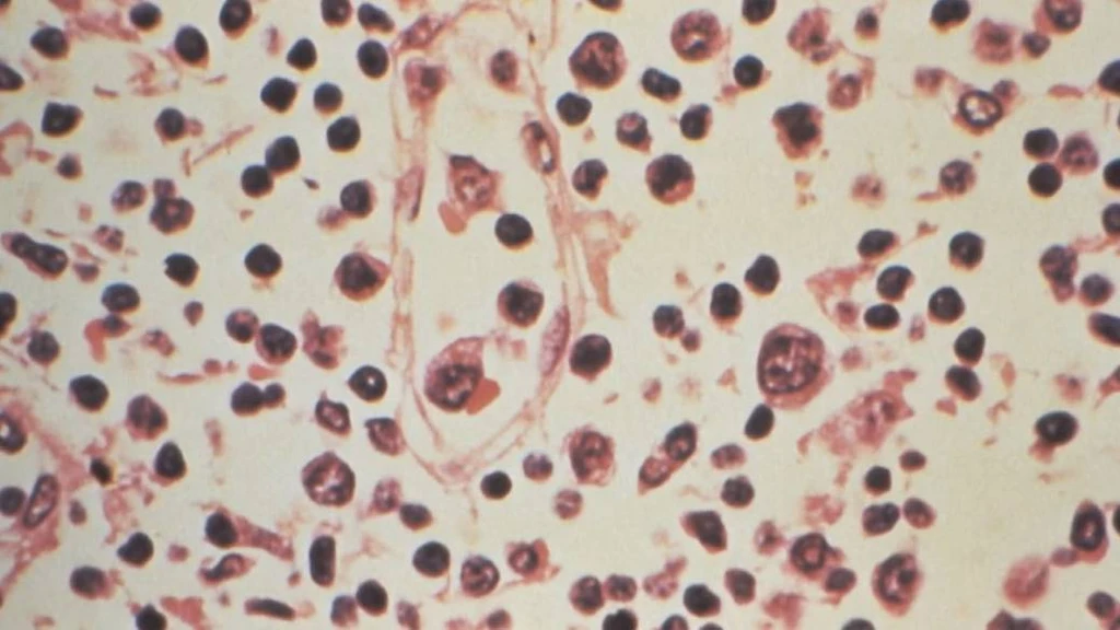 - Figure 1 - 