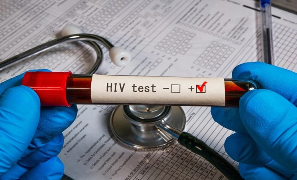 CAR-T Trial Access Disparities Persist for HIV Patients