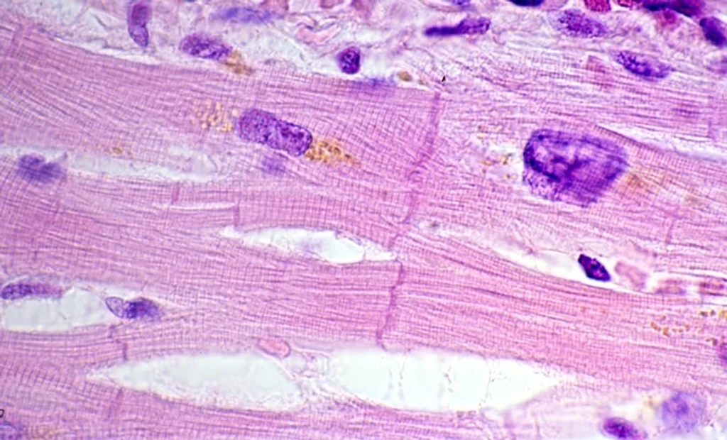 Cholesterol Pathway Disruption Identified as Key Driver in Heart Disease