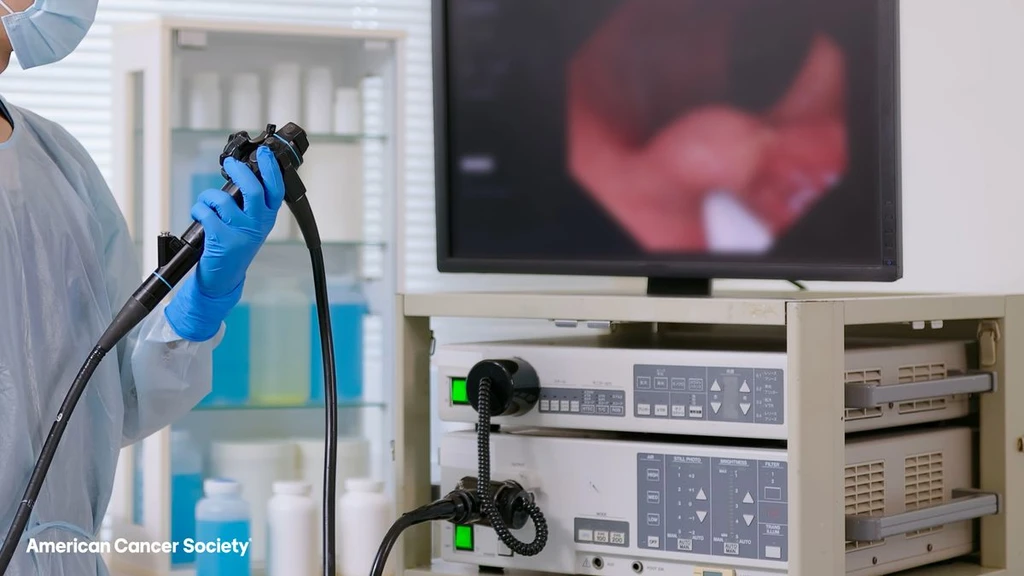 Colorectal Cancer Now Top Cause of Deaths in Young Adults