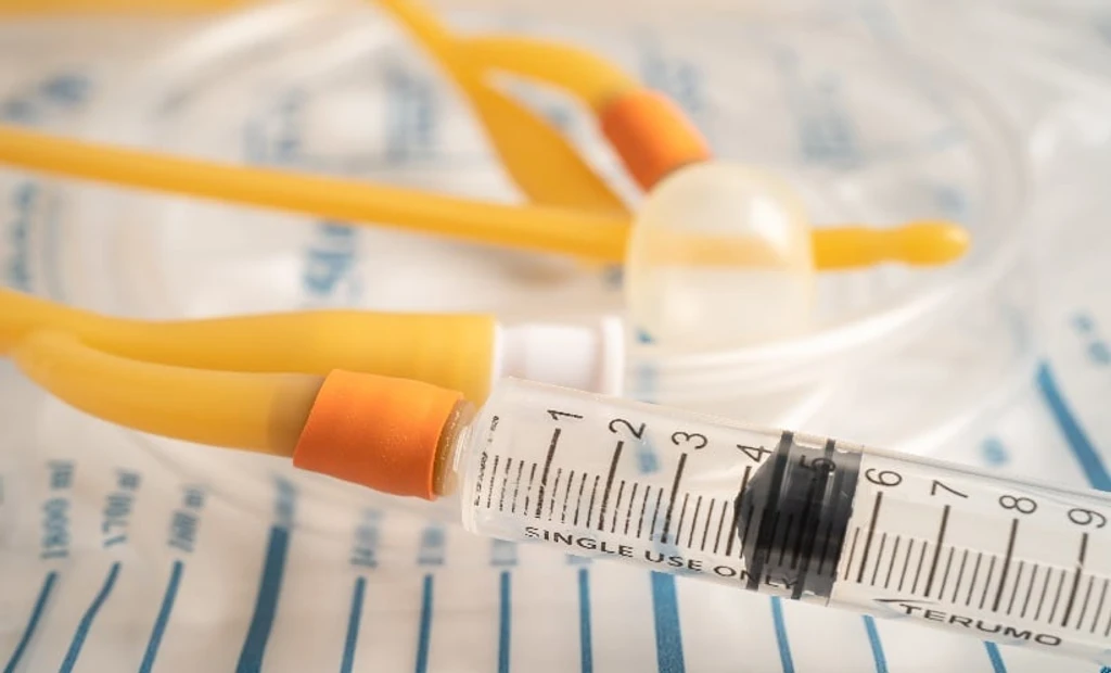 Catheter Reinsertion, Not Duration, Fuels CAUTI in Pelvic Fracture Patients