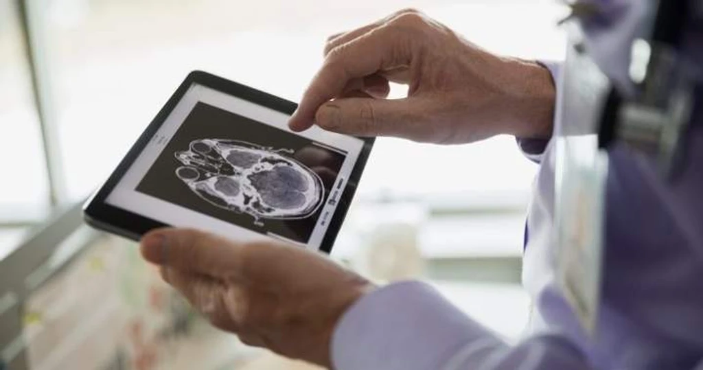 Alberta's Plan to Fast-Track Medical Tests Without Referrals Sparks Doctor Concerns
