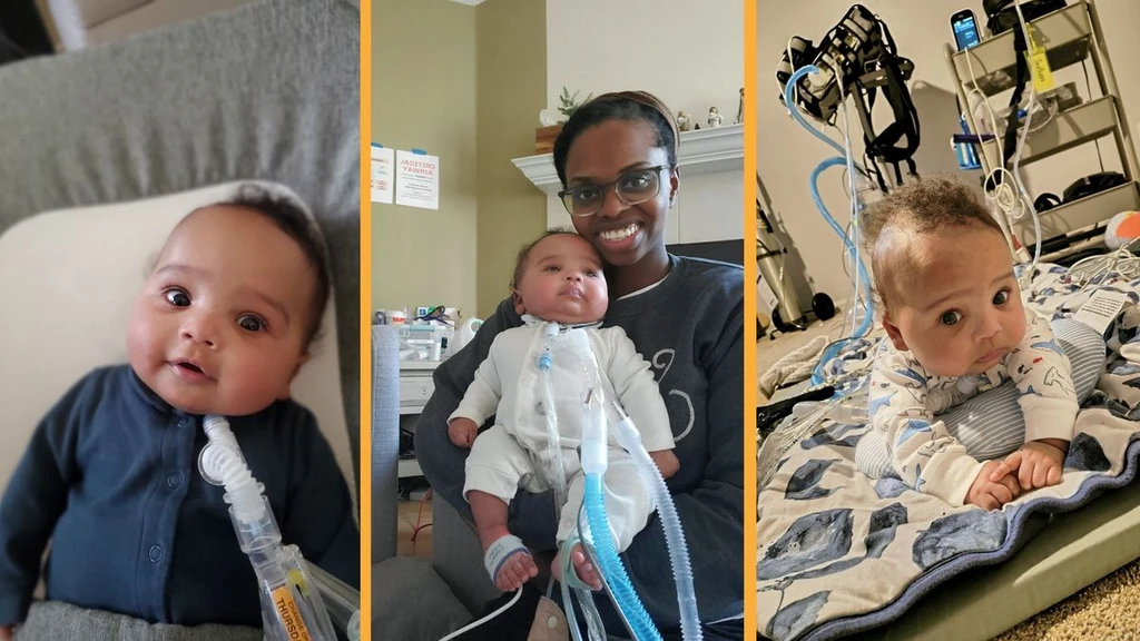 Pioneering In-Utero Surgery at 25 Weeks Saves Infant from Fatal Lung Disorder