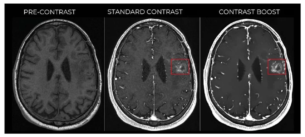 - Figure 1 - 