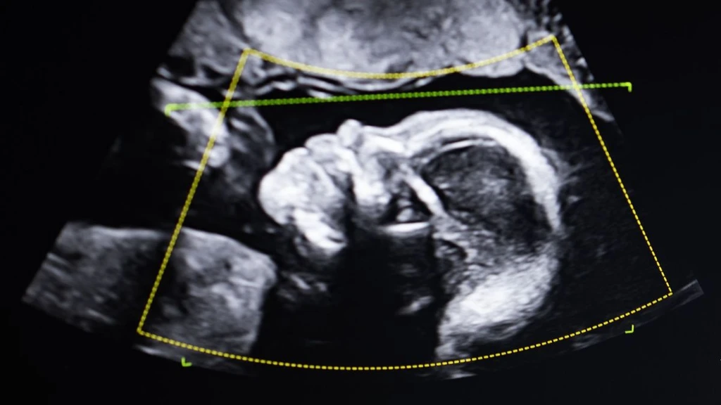 DNA's Unsettling Twist: When Birth Doesn't Match Biology