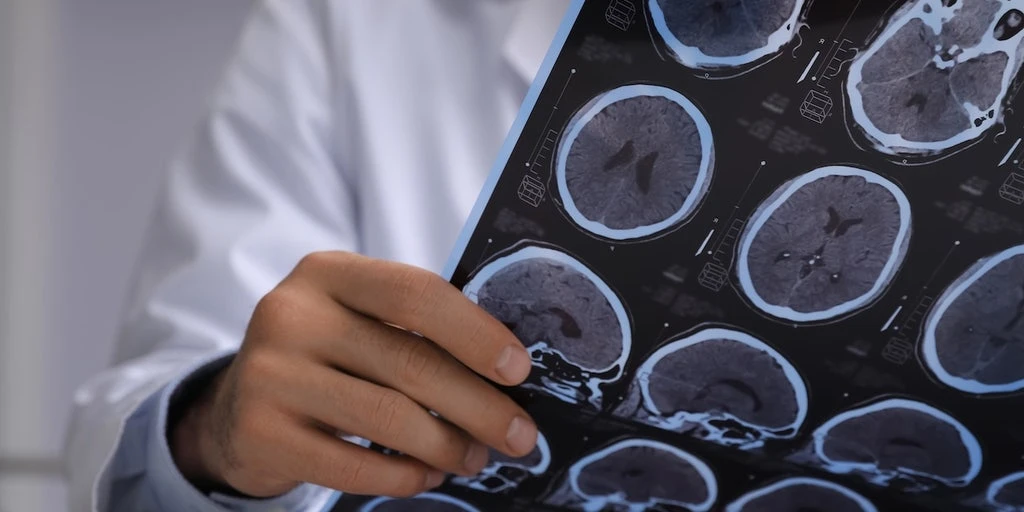 Spanish Man’s Suspected Brain Cancer Revealed as Live Parasitic Tapeworms