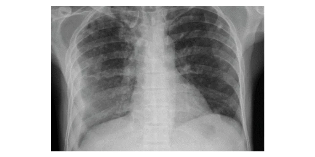 - Figure 1 - 