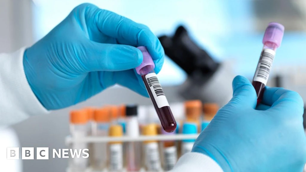 Ebola Scare in Brazil: Two Suspected Cases Test Negative