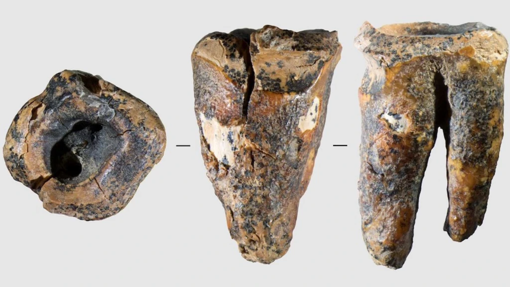 Neanderthals Practiced Dentistry 60,000 Years Ago in Siberia