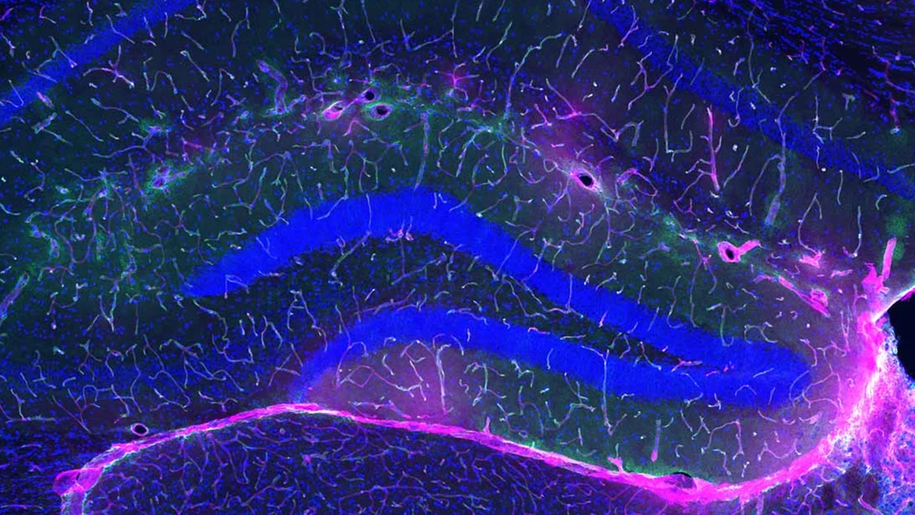 Exercise's Alzheimer's Defense: Scientists Uncover Key Brain Barrier Mechanism