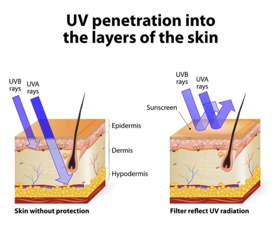 - Figure 1 -