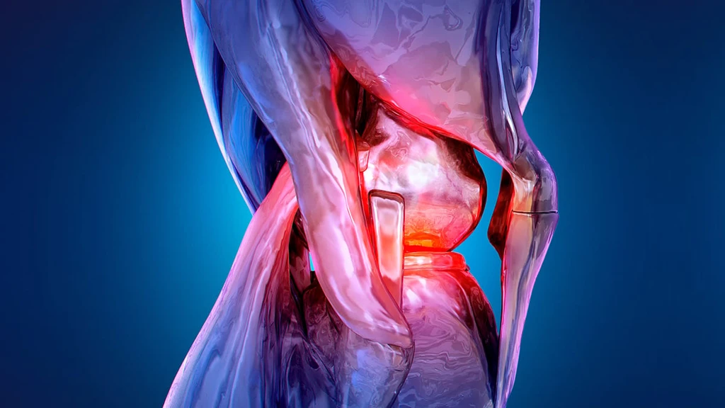 New Minimally Invasive Knee Procedure Cuts Pain in Half