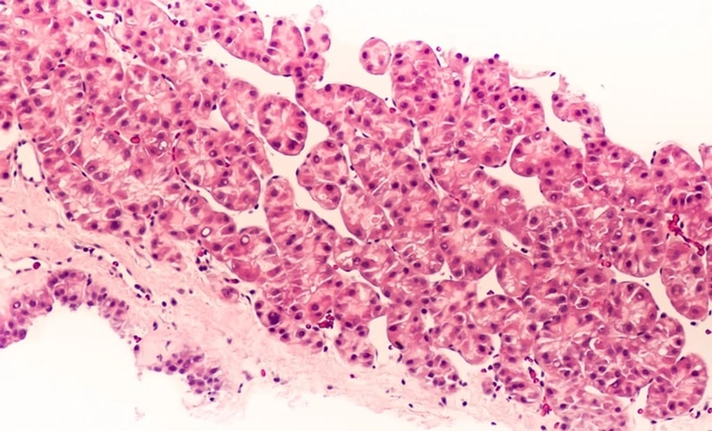AKAP1: A Revolutionary Target in Liver Cancer Metabolism