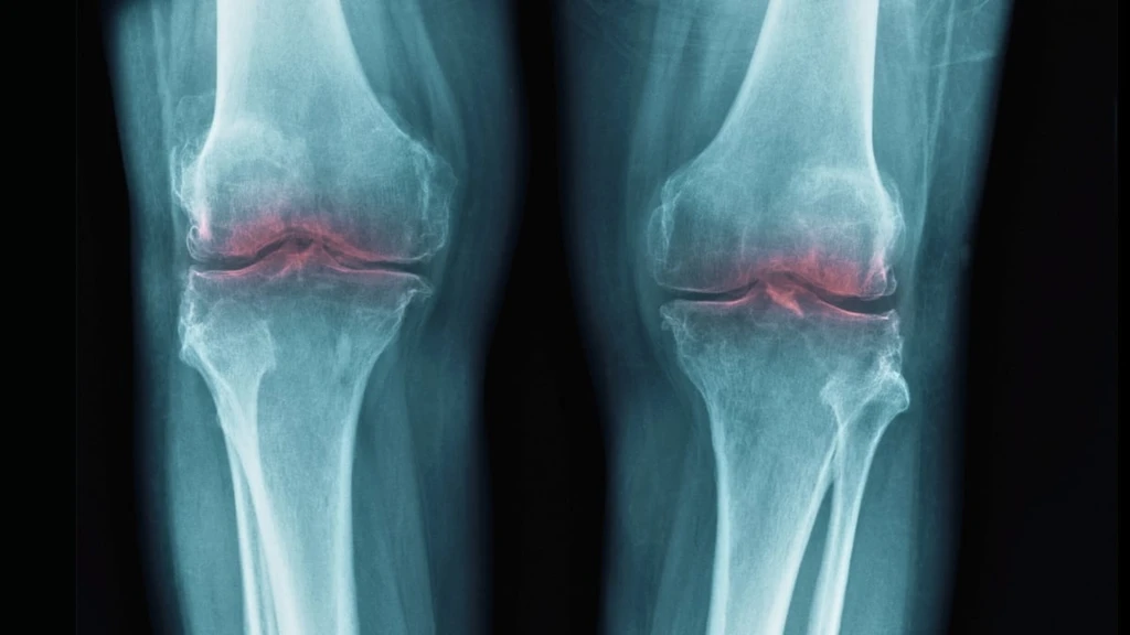 New Protein Discovery Offers Hope for Reversing Osteoarthritis