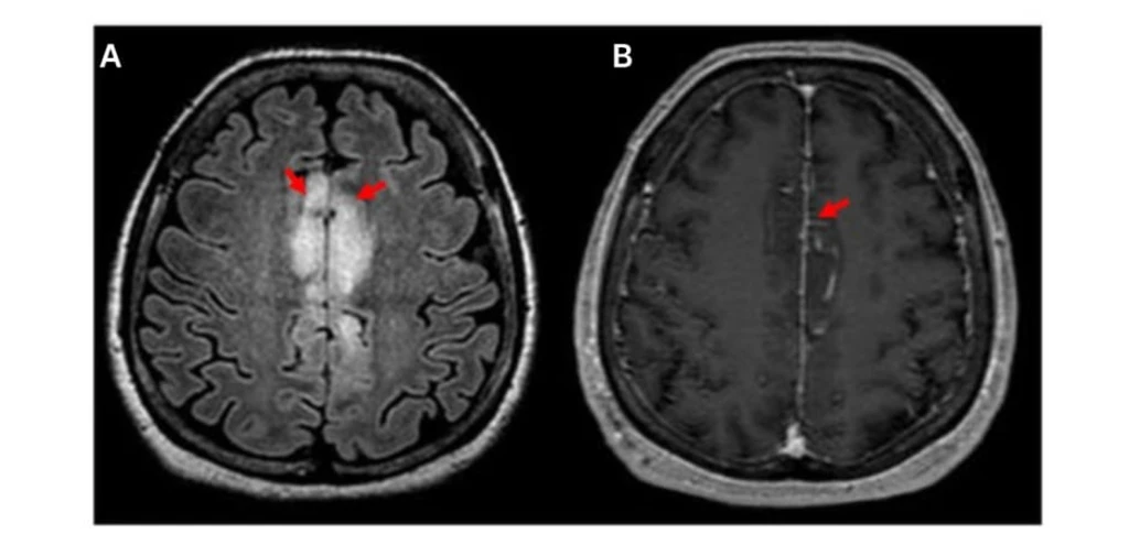 - Figure 1 -