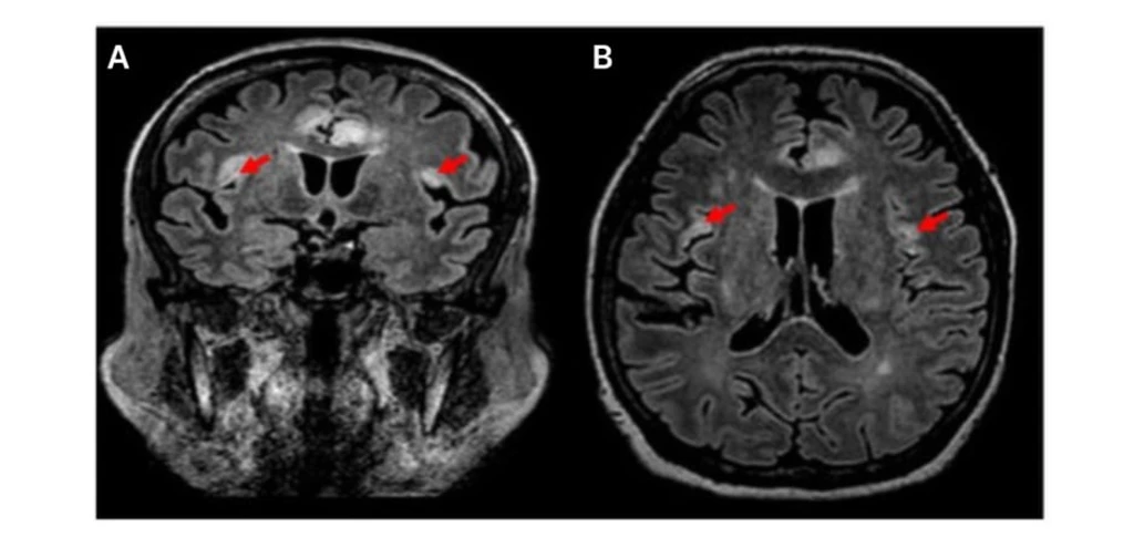 - Figure 2 -
