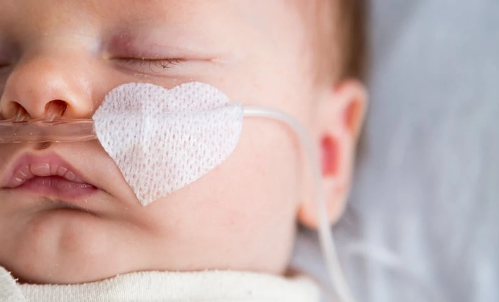 HFOV Shows Promise in Reducing Lung Disease in Preterm Infants
