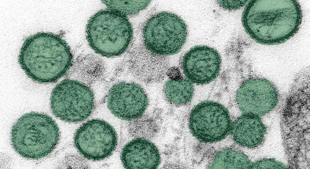 Third Death Linked to Hantavirus Outbreak on Dutch Ship