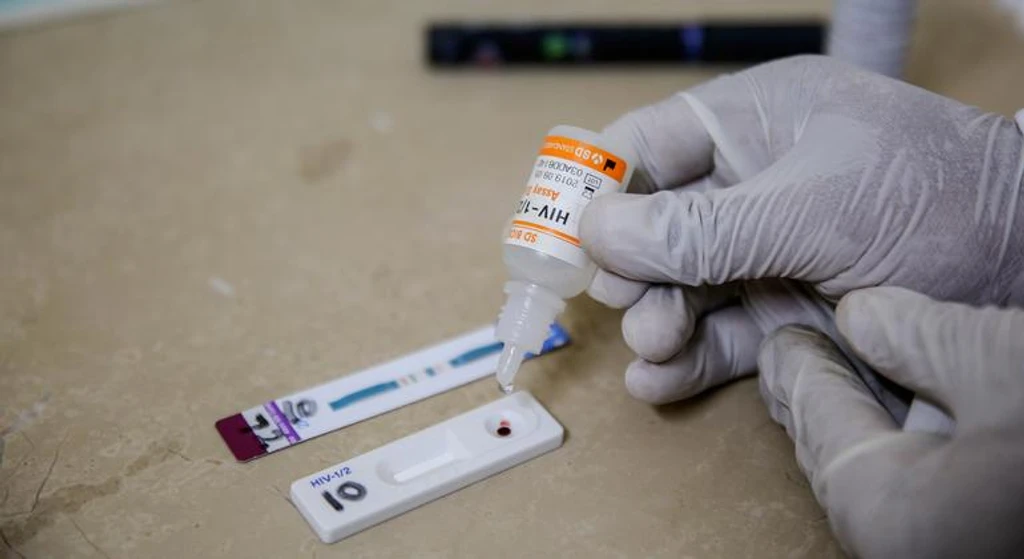 UNAIDS Warns of Historic Reversal in Global HIV/AIDS Progress Amid Funding Cuts