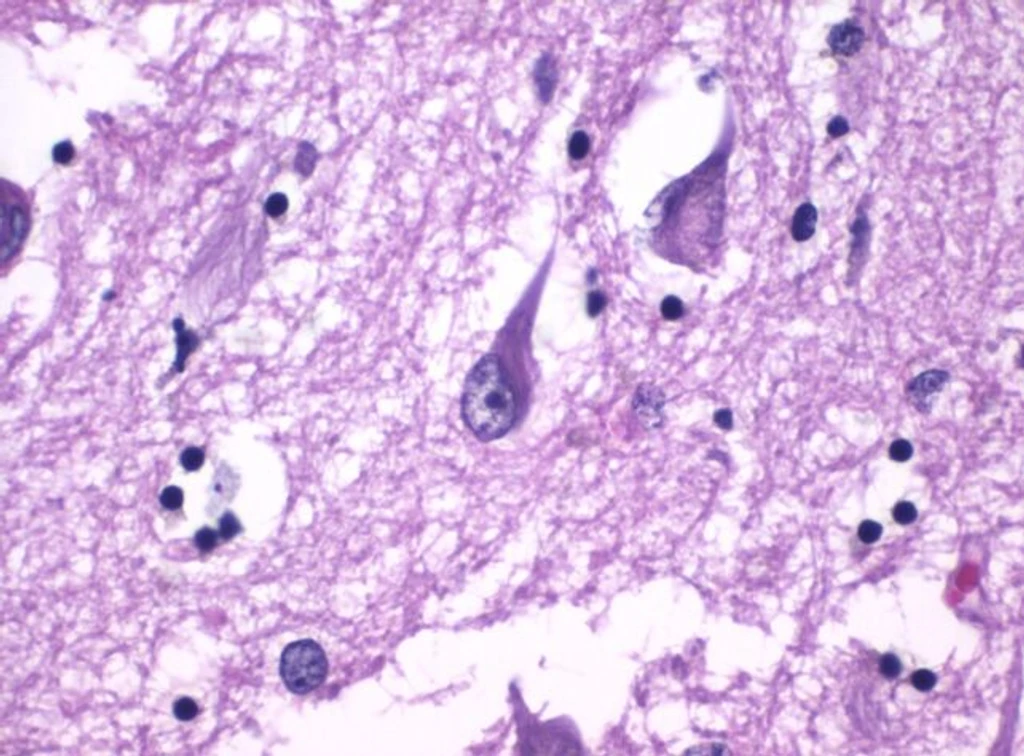 - Figure 1 - 
