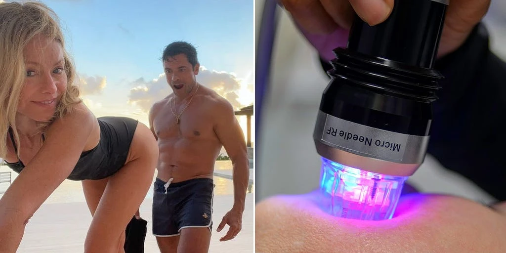 Kelly Ripa Reveals 'Desperate' Butt Microneedling Procedure