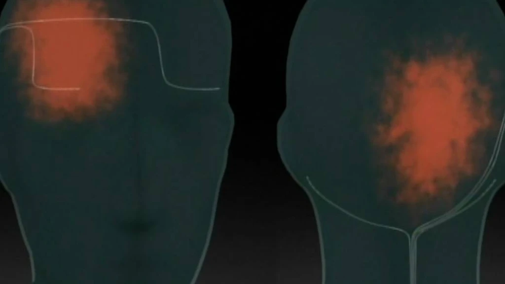 - Figure 1 - 