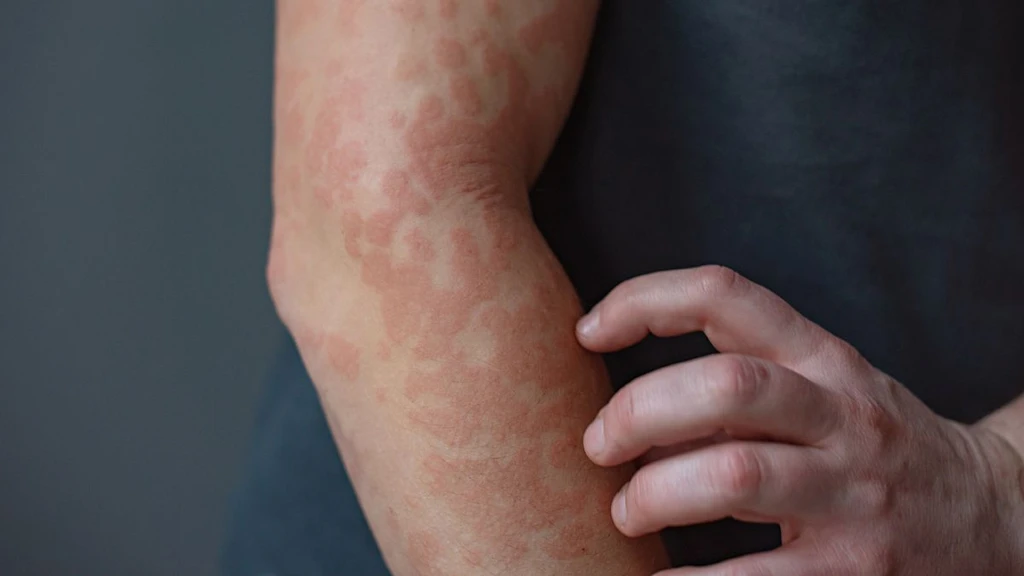 Keratin Protein Discovery Offers New Hope for Skin Inflammation Treatments