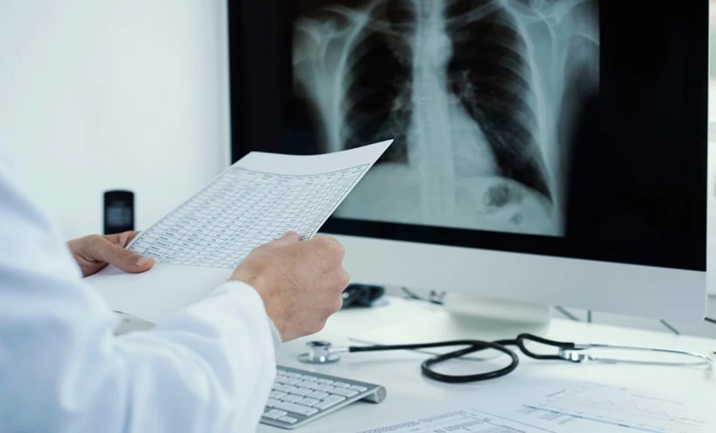 Lysine Boosts Survival in Acute Lung Injury Models