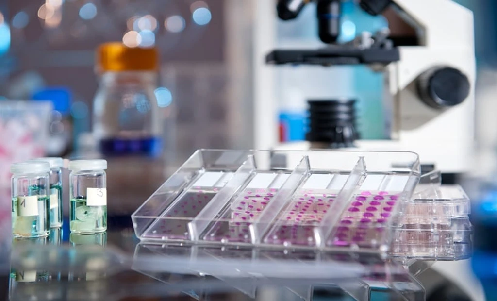 Liquid Biopsy Shows Promise for High-Risk Localized Prostate Cancer