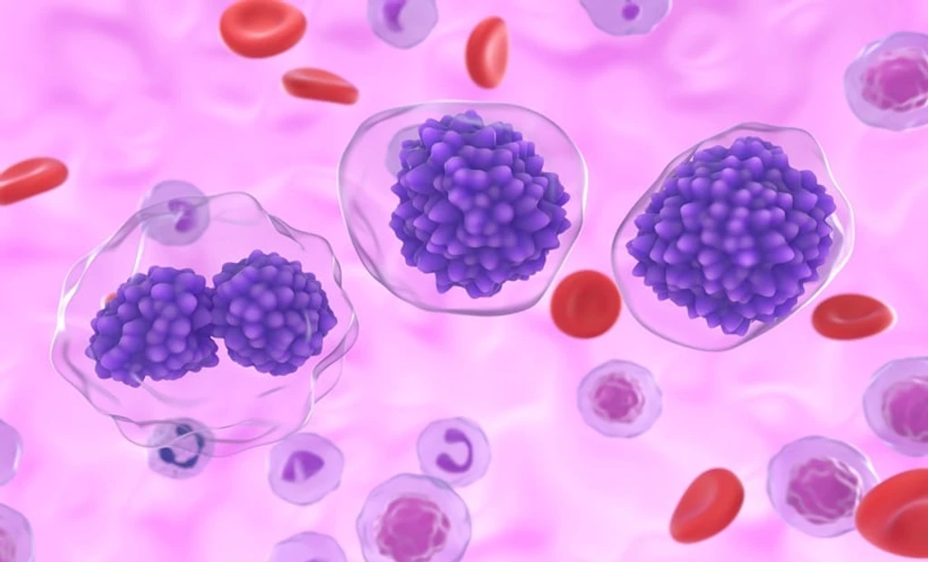 Lymphocyte Growth Rate Key Predictor for CAR-T Therapy Success in Lymphoma
